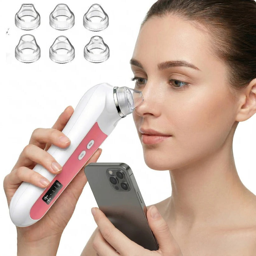Smart Blackhead Remover with 1080P camera for precise pore vacuuming & deep facial cleaning.