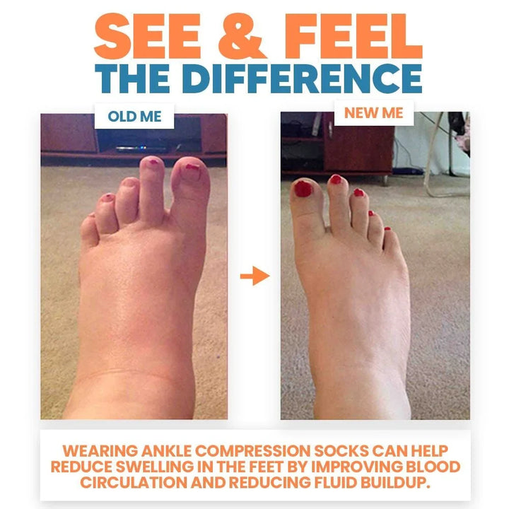 Side view of foot in compression sock, illustrating ankle stabilization & arch support